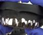 How To Clean A Gold Grill